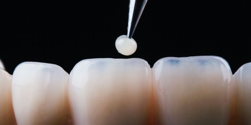 Advanced Dental Implant Technology